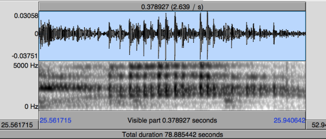 You can see my vocal chords snapping together weirdly in the striations.