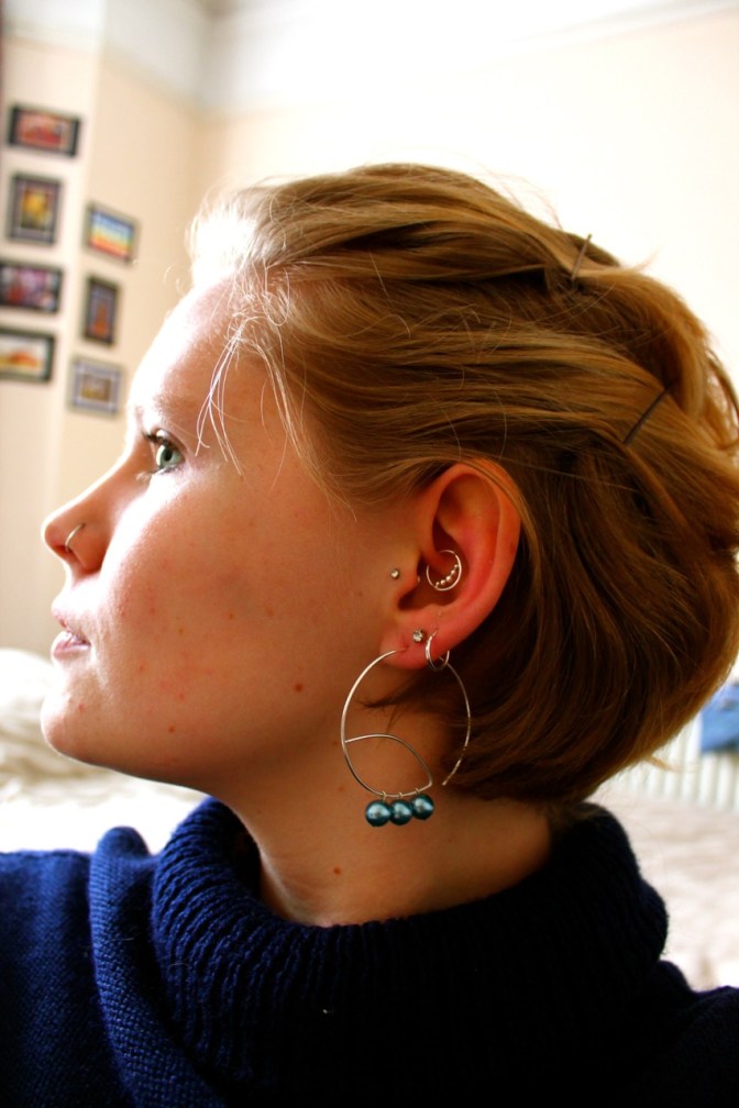 Healed and bejewelled!